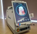 biolase_waterlase_express_dental_soft_tissue_laser